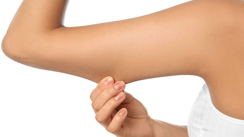 imagem lateral e ampliada do braço levantado de uma mulher sob um fundo branco, que belisca com a outra mão o excesso de gordura na parte posterior do braço