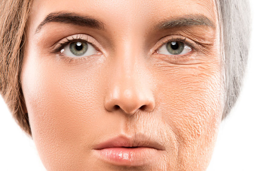 Imagem frontal do rosto de uma mulher, sob um fundo branco; a metade esquerda apresenta uma face jovem e a metade direita uma face envelhecida, com muitas rugas e perda de volume